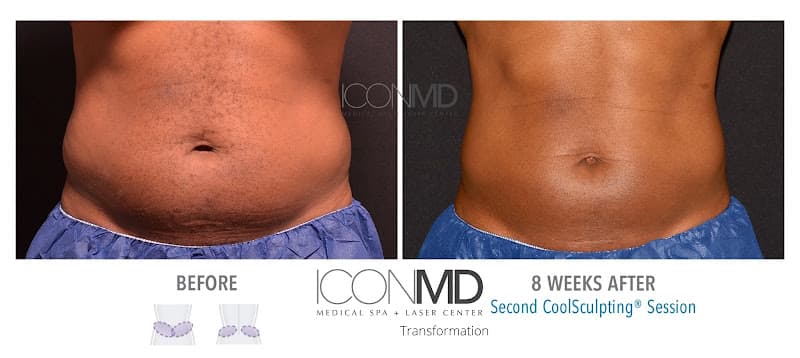 Icon MD Medical Spa + Laser Center Boston clinic