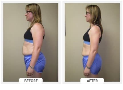 Ballantyne Weight Loss Center clinic